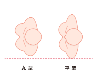 ポイント2の画像